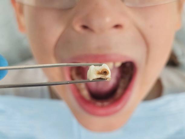 Best Emergency Dental Care for Trauma or Injury in Van Vleck, TX