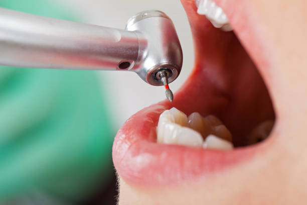 Best Emergency Wisdom Teeth Removal in Van Vleck, TX